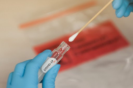 Lấy mẫu xét nghiệm SARS-CoV-2