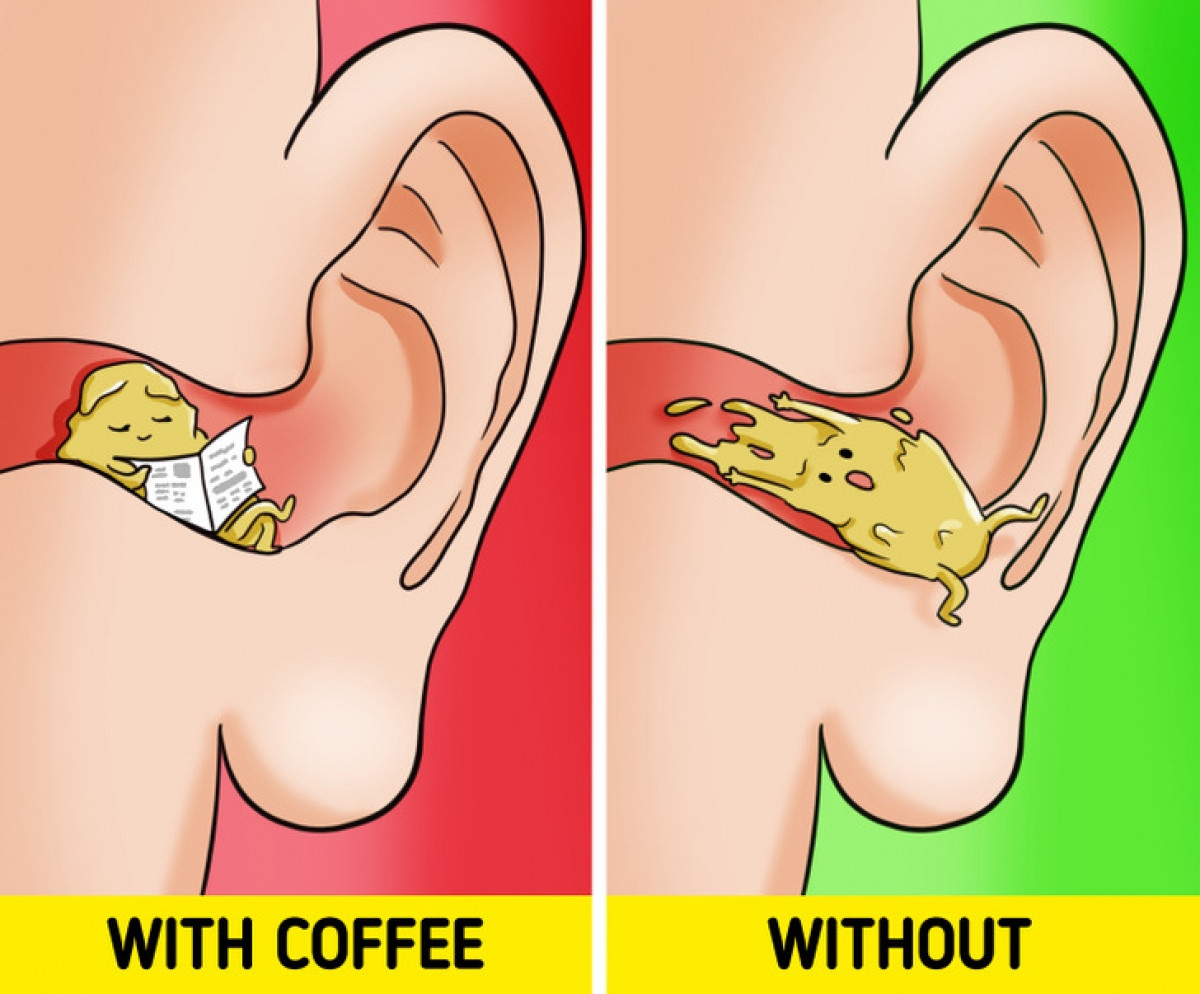 Đột nhiên ráy tai xuất hiện nhiều hơn bình thường? Đây có thể là những lý  do dẫn đến tình trạng này