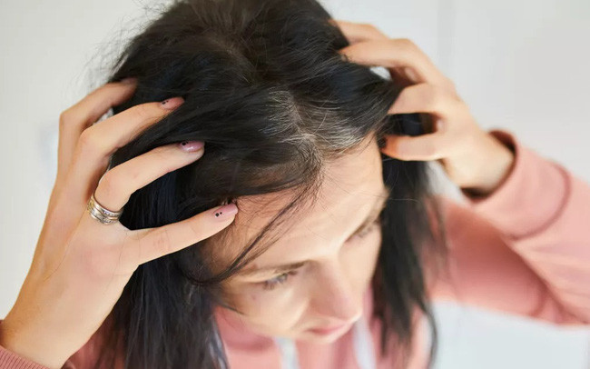 9 Nguyên nhân gây tóc bạc sớm ở nam giới